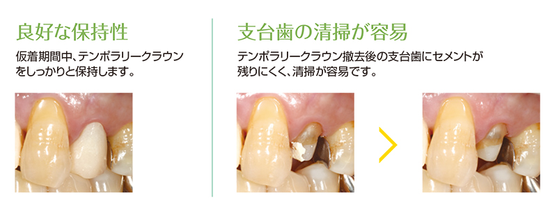 高い保持性と除去性を両立